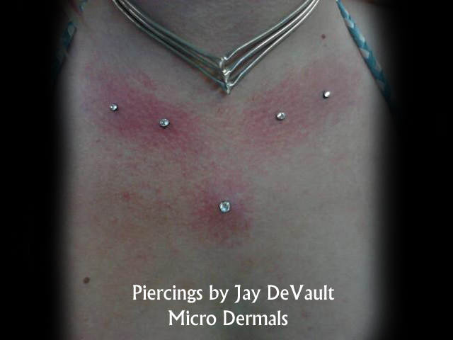 Dermal vagina piercing Dermal vagina piercing